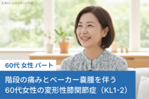 階段の痛みとベーカー嚢腫を伴う60代女性の変形性膝関節症（KL1-2）