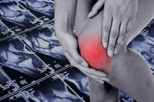 しゃがんで膝からポキポキ音が鳴る原因は？ 見逃せない変形性膝関節症の兆候