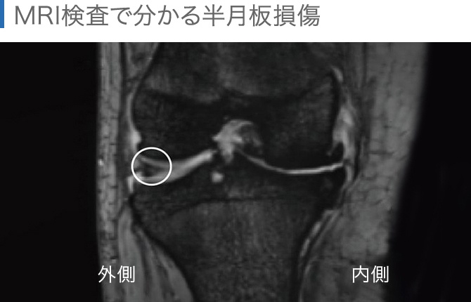 関節のMRI 第2版 | 福田国彦, 上谷雅孝, 杉本英治, 江原 茂 |本