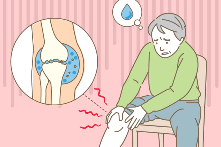 膝に水が溜まったらすぐ抜くなどの対処を 専門医が理由を解説 ひざ関節症クリニック