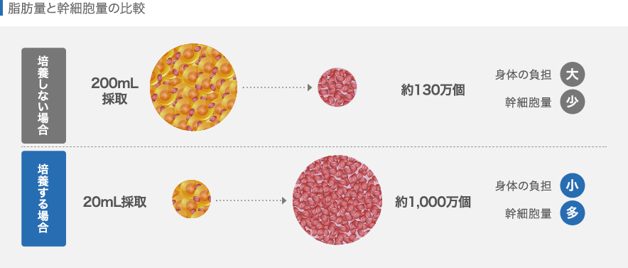 幹細胞治療と培養幹細胞治療の比較