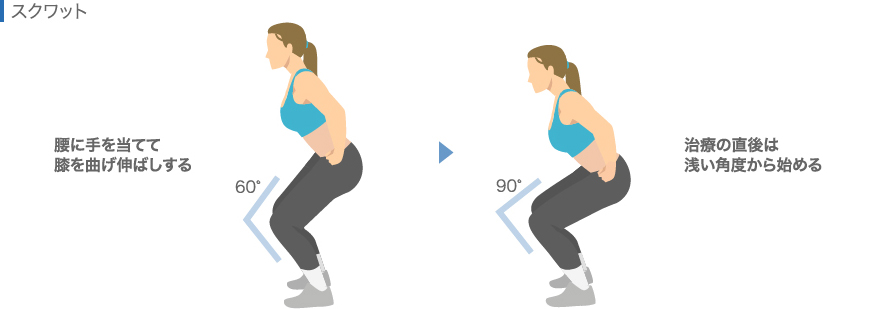 半月板損傷のリハビリ：スクワット（筋トレ）
