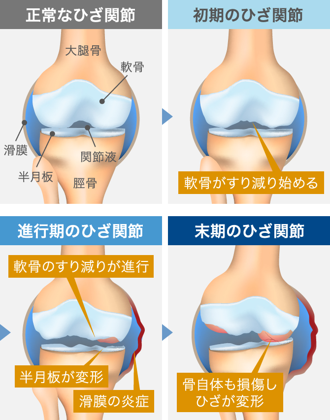 動画で解説 膝が痛いときのおすすめマッサージ