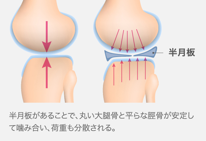 半月板損傷のリハビリ【早く治すために行うべき13の方法】│ひざ関節症