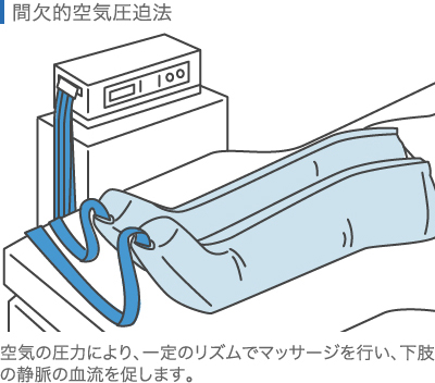 間欠的空気圧迫法