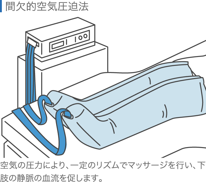 人工膝関節置換術の術後について 合併症と生活上の注意点 ひざ関節症クリニック