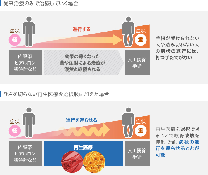 図説 治療選択による進行度の違い～従来の治療と再生医療～