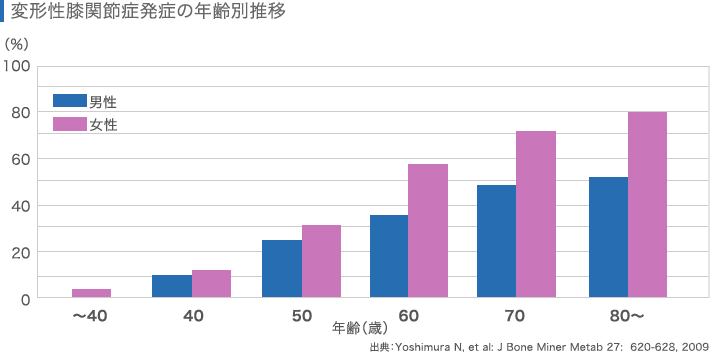 変形性膝関節症発症の年齢別推移