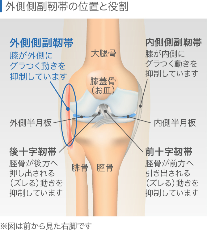 膝外側の痛みはランナー膝 症状緩和のストレッチなど対処法をご紹介 整形外科医監修コラム ひざ関節症クリニック 膝外側の痛みはランナー膝 症状緩和のストレッチなど対処法をご紹介 整形外科医監修コラム ひざ関節症クリニック