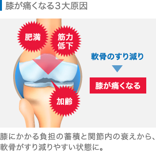 膝が痛くなる3大原因