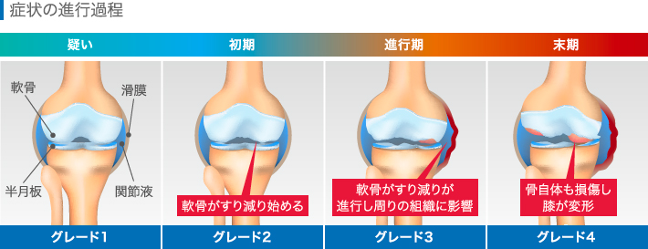 症状の進行過程