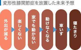 変形性膝関節症を放置した未来