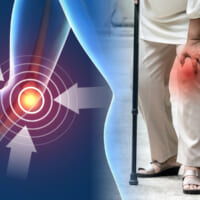 歩くと痛いは膝からのSOS！医師が語る原因とぶり返さない方法
