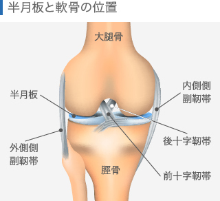 半月板と軟骨の位置