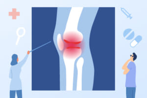 膝の腫れたらどうすべき? 考えられる病気と原因別対処法