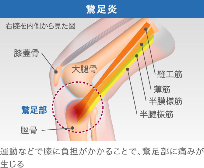 膝が急に痛くなる原因は 考えられる10の原因とその解決法
