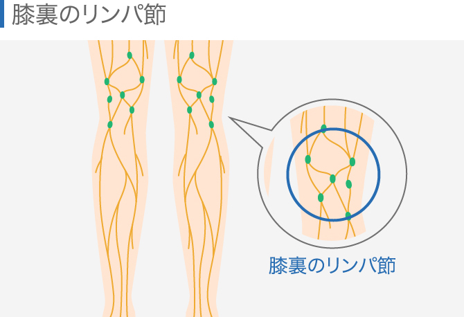 膝が腫れたらどうすべき 考えられる病気と原因別対処法