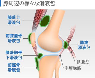 膝周辺の様々な滑液包