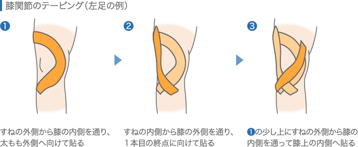 膝関節のテーピング（左足の例）