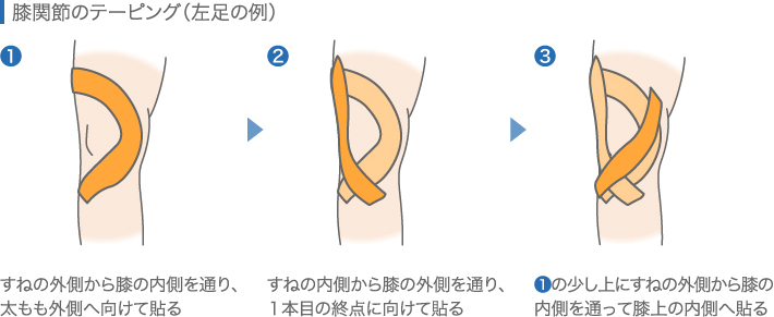 膝関節のテーピング(左足の例)