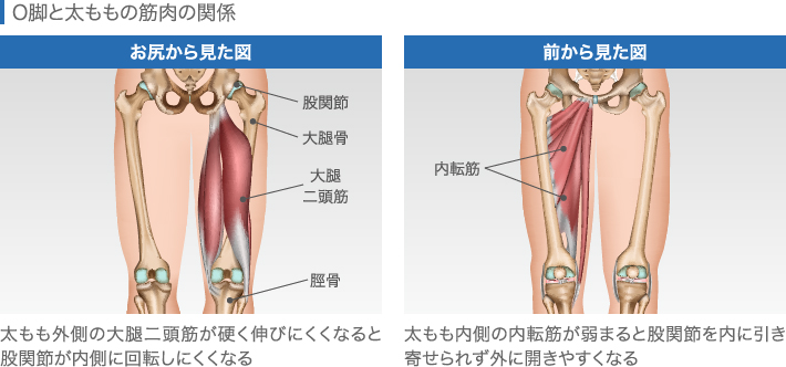 O脚と太ももの筋肉の関係