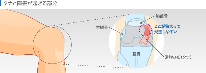 タナと障害が起きる部分