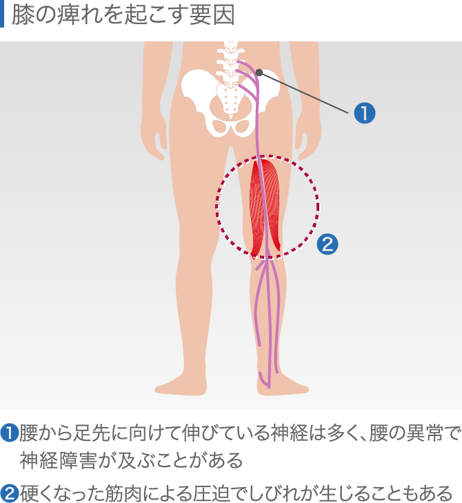 膝の違和感の症状チェック 痛くないけど気になる原因と対処法 膝の違和感の症状チェック 痛くないけど気になる原因と対処法
