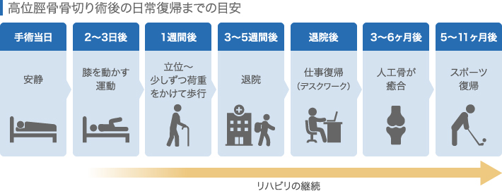 高位脛骨骨切り術後の日常復帰までの期間の目安