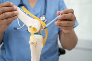 半月板損傷の軽度症状とは？回復を促すためにできるセルフケアや主な治療法を解説