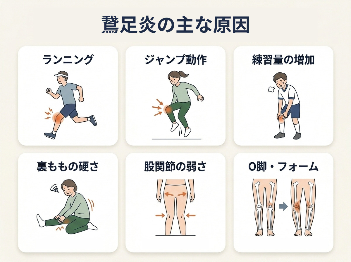 鵞足炎の主な原因