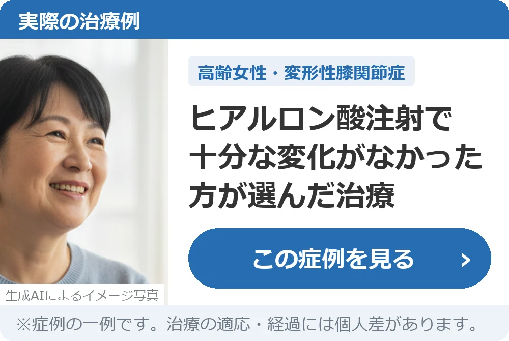 実際の治療例:ヒアルロン酸注射で十分な変化がなかった方が選んだ治療