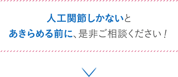 人工関節しかないとあきらめる前に、是非ご相談ください！