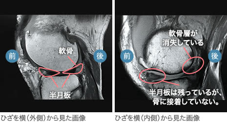 ひざ関節症クリニック Mri即日ひざ診断