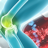 PRP-FD(PFC-FD)注射