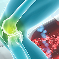 PRP-FD(PFC-FD)注射