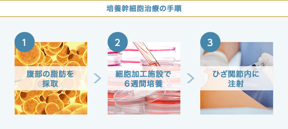 培養幹細胞治療のフロー