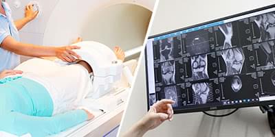 事前のMRI検査でひざの状態を詳しくチェック