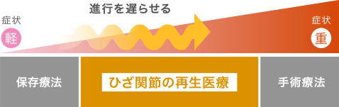 再生医療について