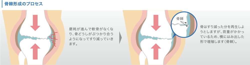骨棘形成のプロセス