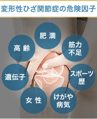 変形性膝関節症の原因