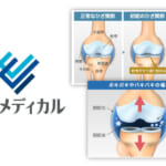 「時事メディカル」に連載中の尾辻医師のひざ痛治療コラムが新たに掲載されました