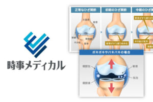 「時事メディカル」に連載中の尾辻医師のひざ痛治療コラムが新たに掲載されました