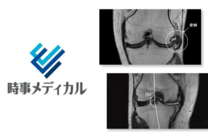 尾辻医師の連載コラムが新たに時事メディカルに掲載されました