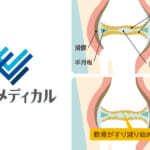 時事メディカルに尾辻ドクター連載の最新コラムが掲載されました