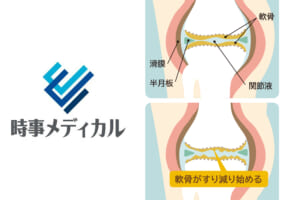 時事メディカルに尾辻ドクター連載の最新コラムが掲載されました